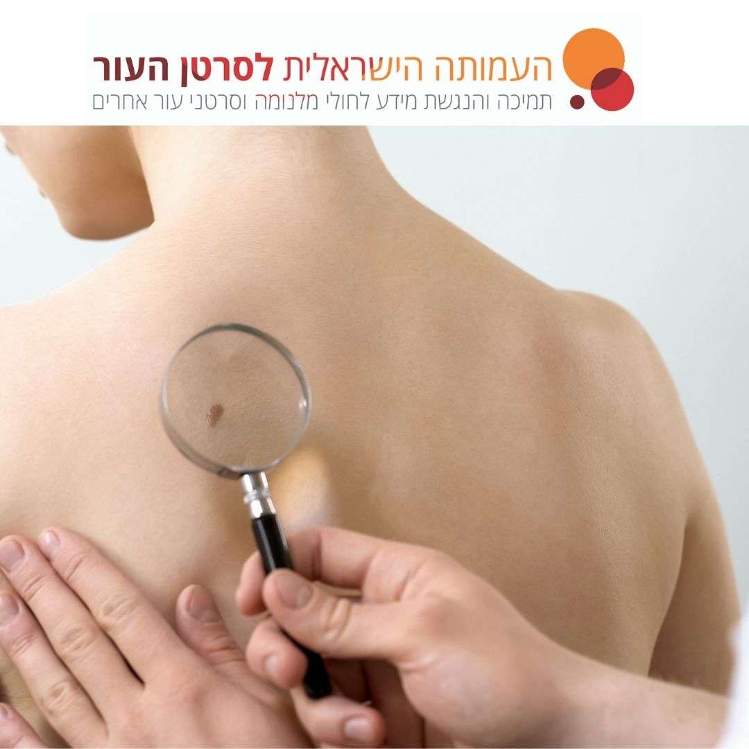 You are currently viewing מלנומה אמלנוטית – שאלות ותשובות